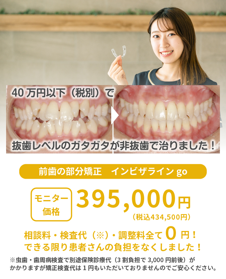 歯科医院でできる、手軽に歯を白くするオフィスホワイトニング税込6,600円